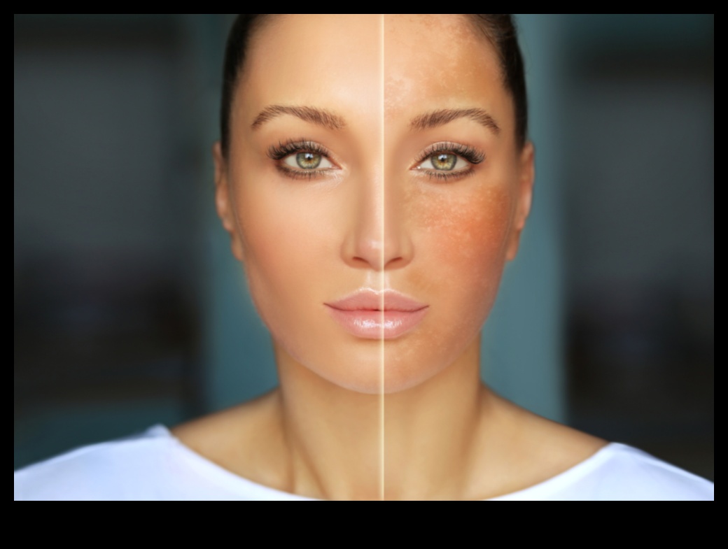 Cum poluarea vă dăunează pielii (și cum să o protejați) 3 Impactul poluării asupra pielii dvs.: protecție împotriva factorilor de stres de mediu